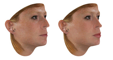 simulador-3D-cirugias-plasticas
