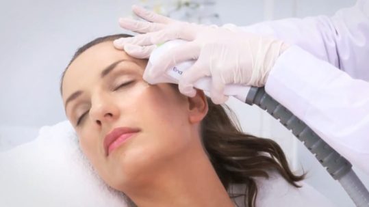 Mujer en tratamiento de radiofrecuencia facial espera buenos resultados