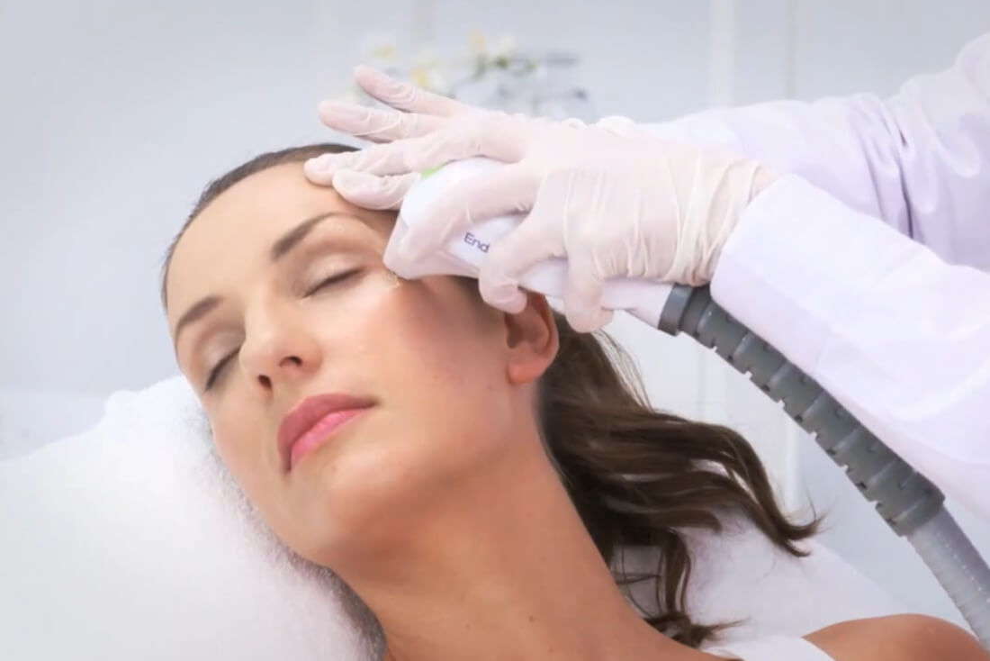 Mujer en tratamiento de radiofrecuencia facial espera buenos resultados