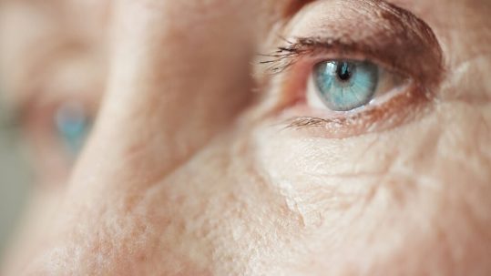 Mirada rejuvenecida de paciente mayor, resultado de una blefaroplastia