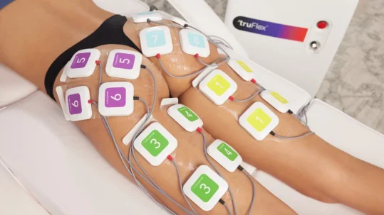 Paciente de electroestimulación muscular estética logrando beneficios