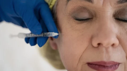 Mujer a la que están haciendo un tratamiento de mesolifting facial