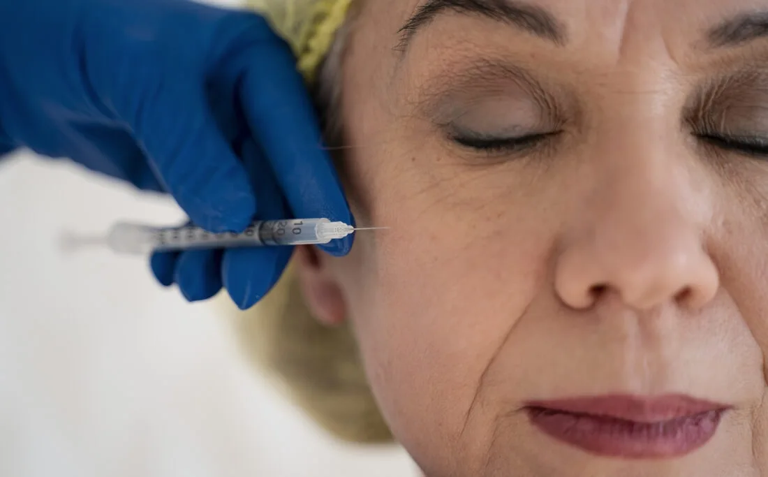 Mujer a la que están haciendo un tratamiento de mesolifting facial